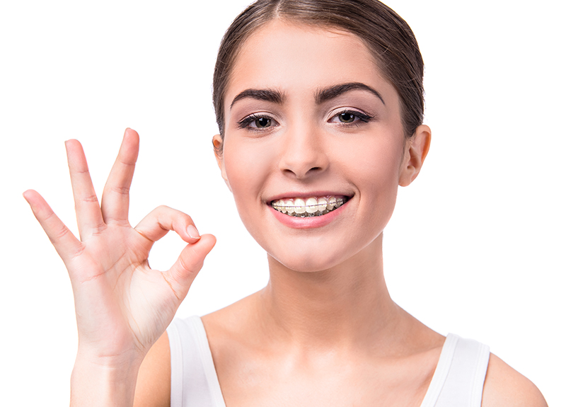 woman with white clear ceramic braces